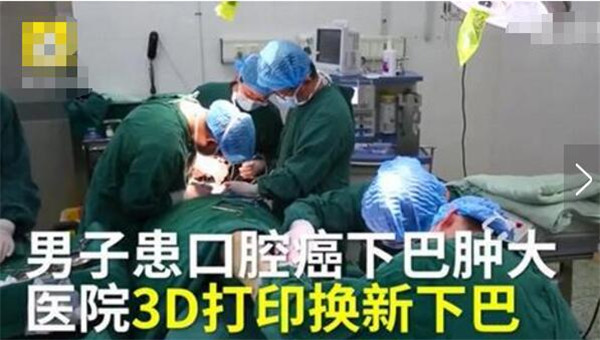 “医生用3D打印为患者换下新下巴”上了微博热搜？这是怎么回事？！